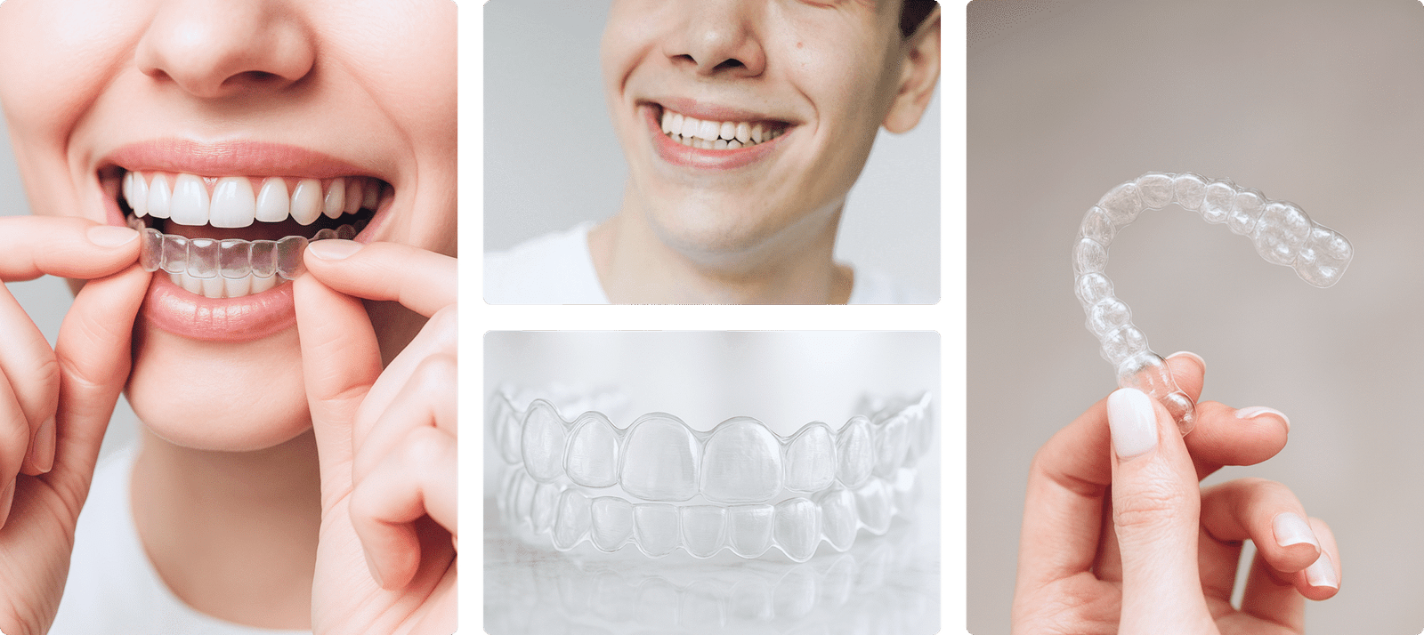 Lächelnde Patientinnen und Patienten mit Zahnspange nach erfolgreicher Behandlung in Krems